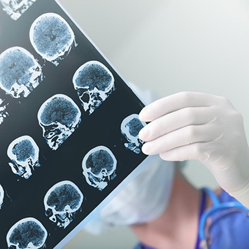 brain x-rays