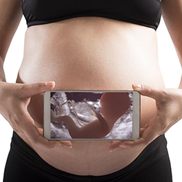 pregnant woman holding phone with sonigram photo in front of belly
