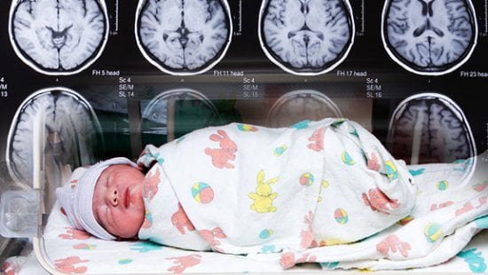 infant with brain scans behind them